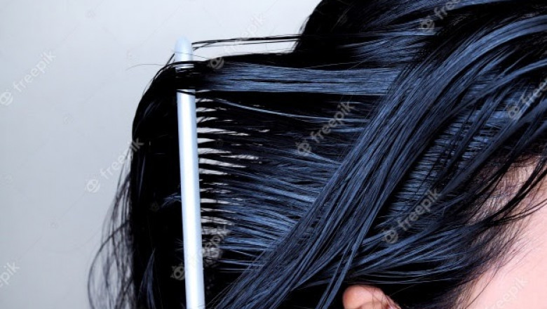 Greasy hair Various causes and solutions available