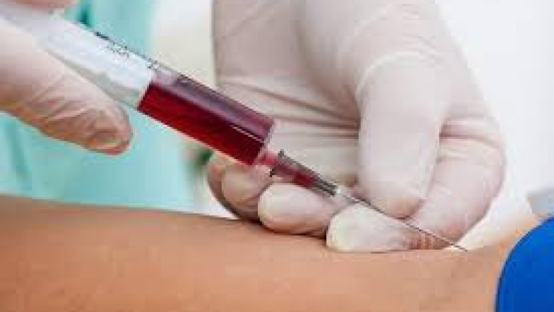 Carcinoembryonic Antigen Market Strategies, Technological Innovation, Trends & Top Players, Forecast to 2027