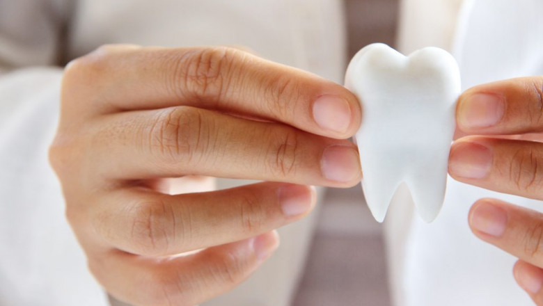 Best Dental Implant Dentist in Houston