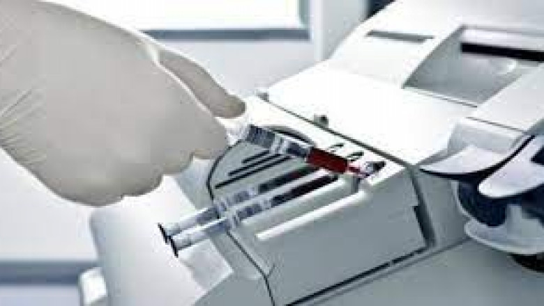 Blood Gas and Electrolyte Analyzer Market Forecast to 2028 and Global Analysis