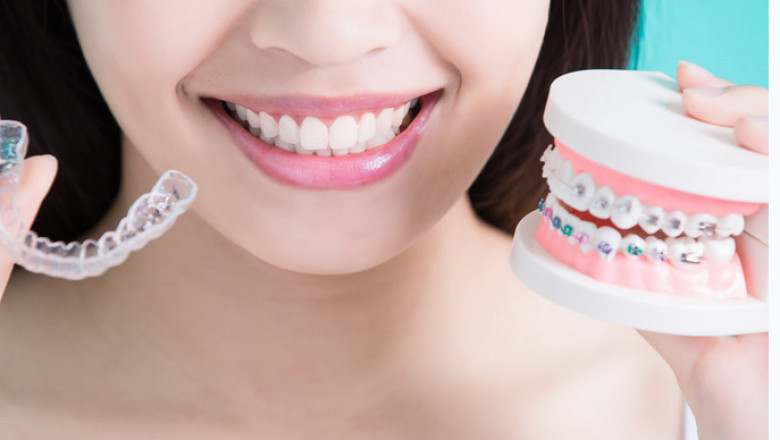 Invisalign in Lake Forest