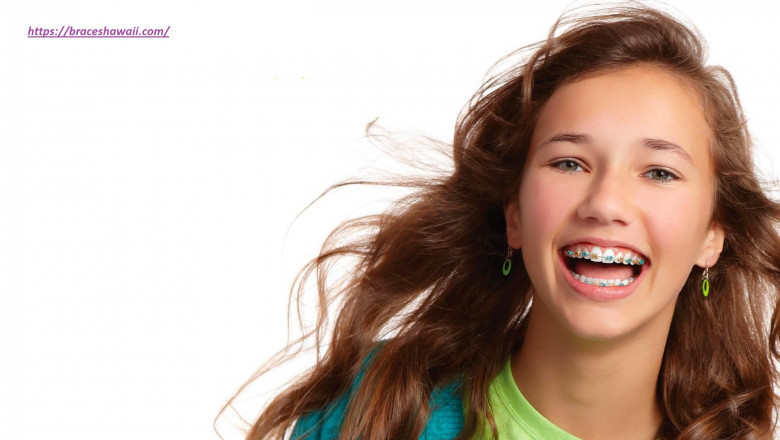 Orthodontist in hawaii braceshawaii