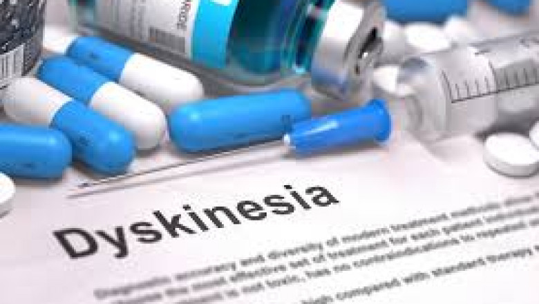 Tardive Dyskinesia Drugs are used to treat tardive dyskinesia, a condition that affects nervous system