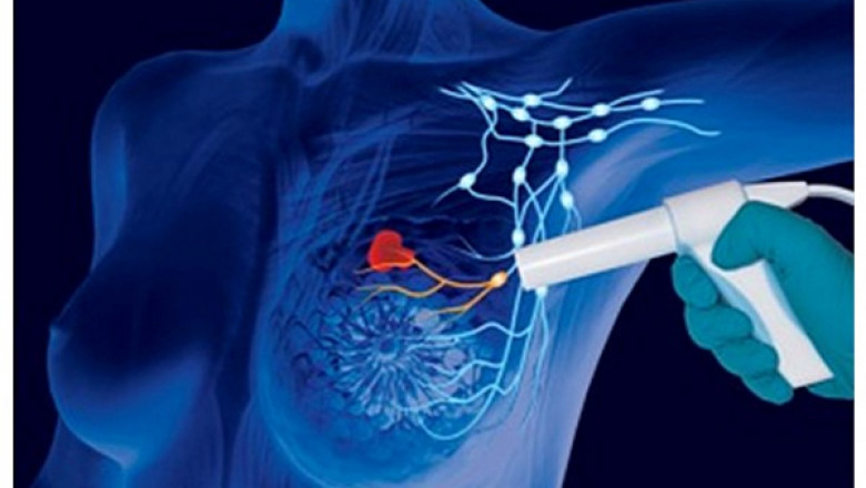 Rising prevalence of breast cancer, demand for Breast Cancer Therapeutics is rapidly increasing