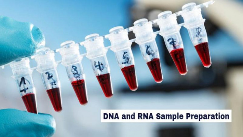DNA and RNA Sample Preparation Market: Prospects, Trends Analysis, Market Size and Forecast