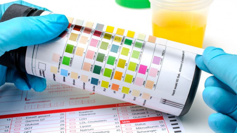 A Great Read Highlighting EtG Drug Tests Awaits You
