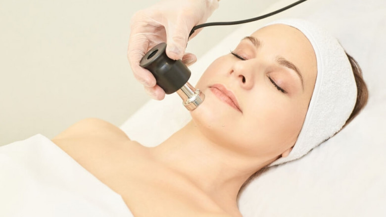 Nose thread lift Vanc ou ver