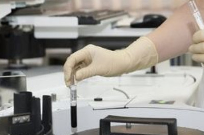 Vitamin Test Market Analysis, Growth, Future Trends, Segmentation, Emerging Technology by 2027