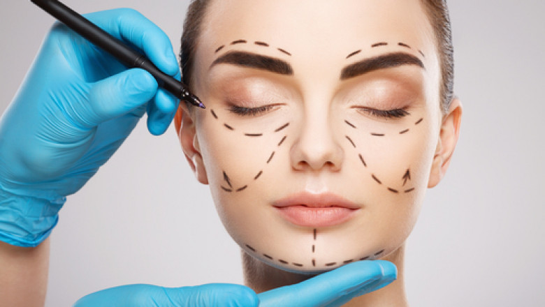 Need to know about Facelift Surgery & Brow lifts surgery