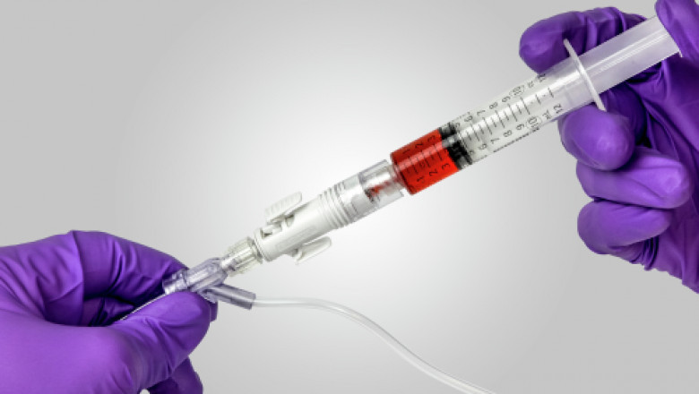 Closed System Transfer Devices Market 2021 Comprehensive Analysis, Business Growing Strategies, Industry Segmentation and Forecast 2028