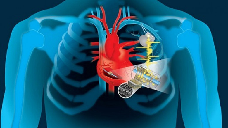 Structural Heart Device Variety of Heart Defects that a Person can be Born with or can Acquire over Time