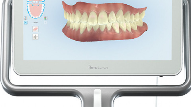 Invisalign Orthodontist in Baltimore - MarkoVitz Orthodontics