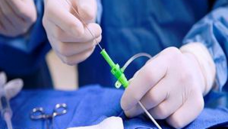 Medical Adhesives And Sealents Are Most Important Part In Medical Industry