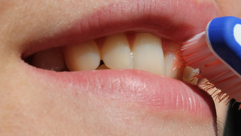 Wisdom Tooth Extraction: All You Need To Know About!