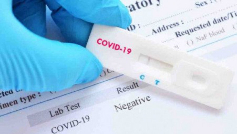 The Day 2 Antigen Test: What To Expect And When To Know If You're Pregnant