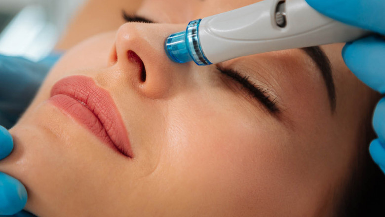 What Are the HydraFacial Benefits For Your Dry Skin?