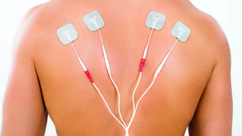 Electrotherapy System, A Strong Method Utilised By Many Physiotherapists, Uses Focused And Regulated Electrical Stimulation To Treat Chronic Pain
