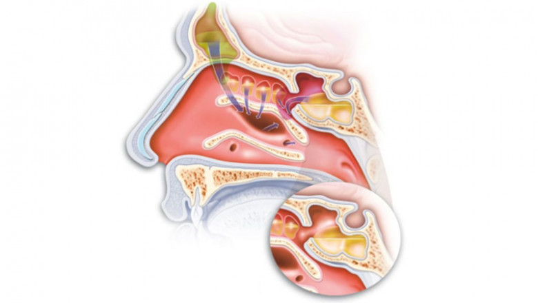 LASER works in ENT Surgery
