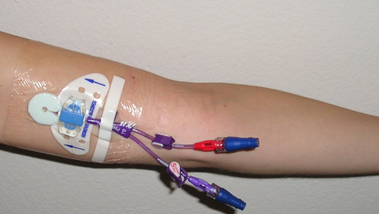 Peripheral Intravenous Catheters (PIVCs) are the most commonly utilised invasive devices