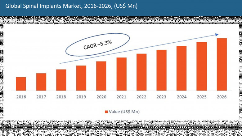 Spinal Implants Market 2021 Rapidly Growing Worldwide in Next 5 Year