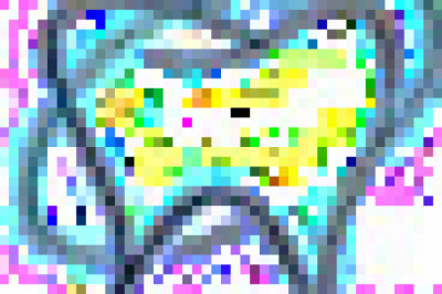 Dentist in Rosslyn - The Mira Dental Care