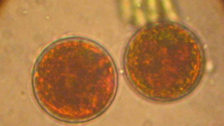 Haematococcus Market Company Business Analysis, Industry Synopsis, Business Outlook 2021 to 2028