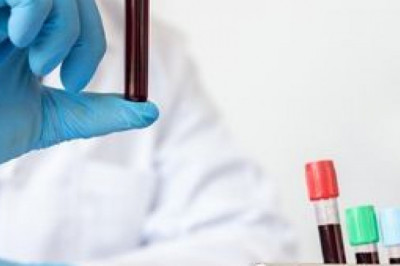 Liquid Biopsy Market Size, Segments, Industry Growth, Emerging Technologies and Trends by 2027