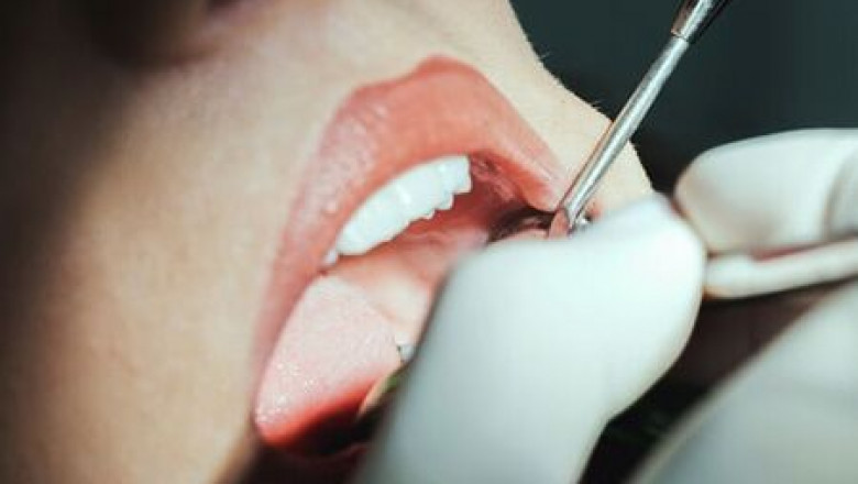 sedation dentistry downtown calgary