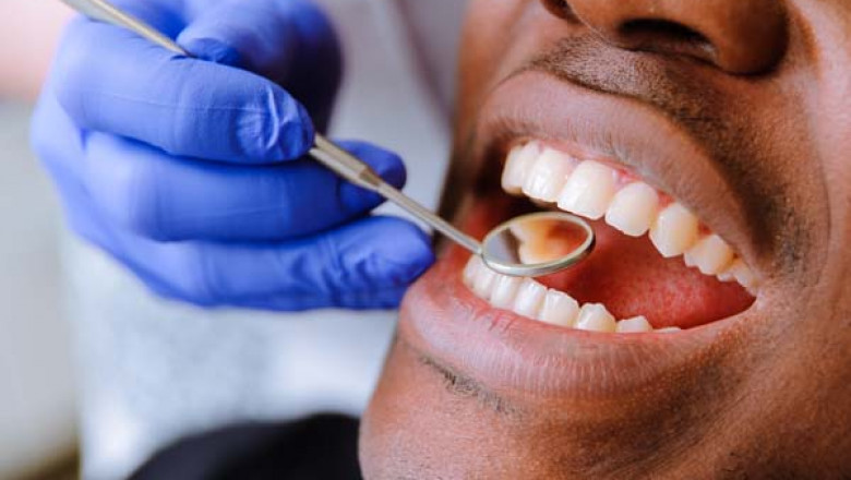 The Secrets to Choosing the Right Cosmetic Dentist!
