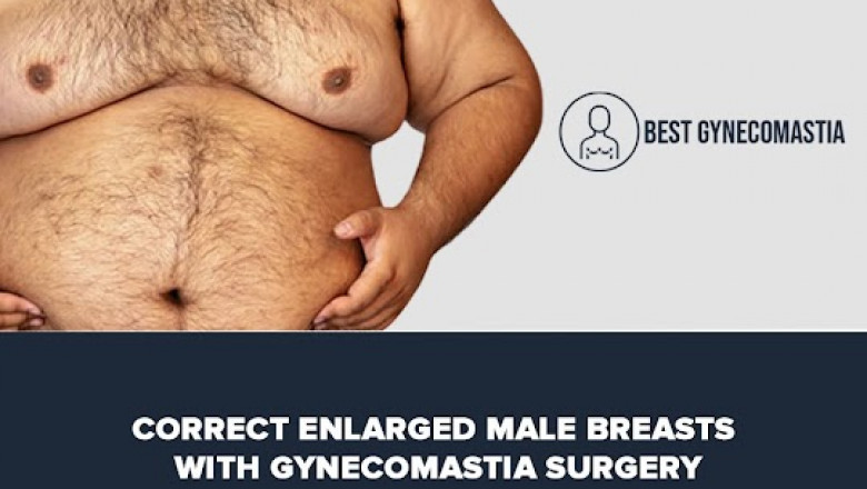 What is the Option for Gynecomastia?
