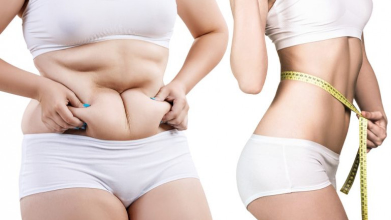 Radiofrequency For Skin Tightening