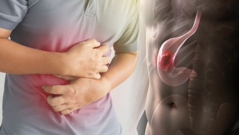 Stomach Cancer Drugs Market Market Broadcasting Latest Headway 2021 to 2027 | Covid-19 Analysis