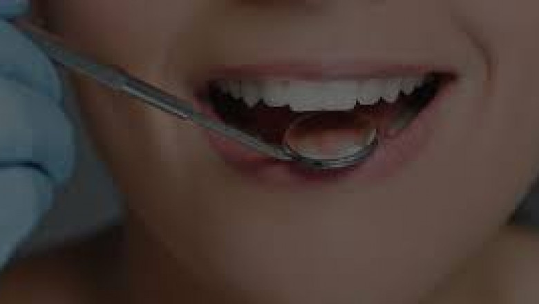 All You Need To Know About Root Canal