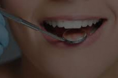 All You Need To Know About Root Canal
