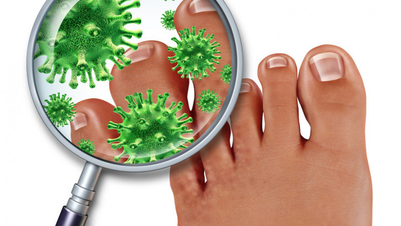 Antifungal Drugs come in a variety of forms.