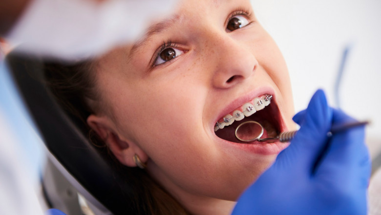 What Makes Early Orthodontic Treatment Necessary?