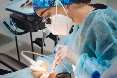 Everything You Need To Know About Root Canal Treatment