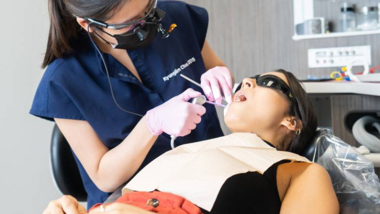 full mouth Dental veneers