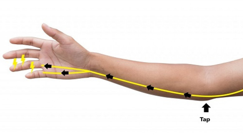 Ulnar Nerve Treatment Market to Witness High Growth, Dynamics, Production, Demand Analysis and Forecast 2021-2028
