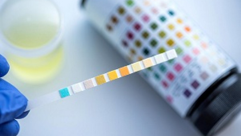Synthetic Urine - Don’t Miss The Opportunity