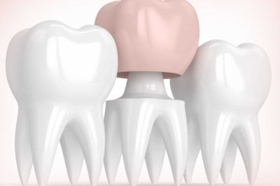 Tooth Crown: Is This Therapy for You?