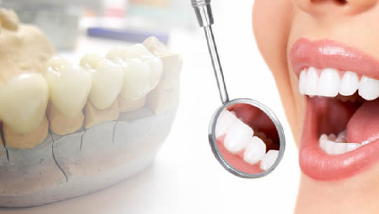 What Are The Different Types Of Dental Prosthetics?