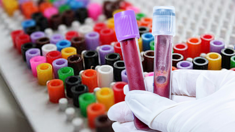 Growing Geriatric Population, Emergence Of Liquid Biopsy Tests, And Increased Blood Donation Campaigns Are Major Factors Driving The Growth Of The Blood Collection Tubes Market