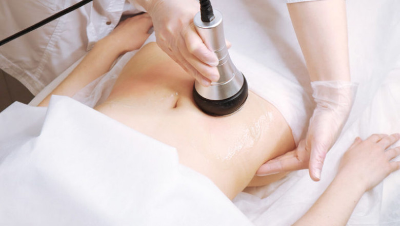 Beauty combination: Cavitation slimming and radio frequency lifting