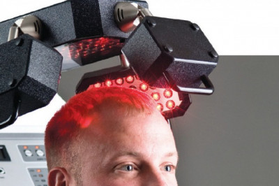 Hair Loss & Growth Treatment Market: Ready To Fly on high Growth Trends | Top Players are Ultrax Labs, Pharma Medico