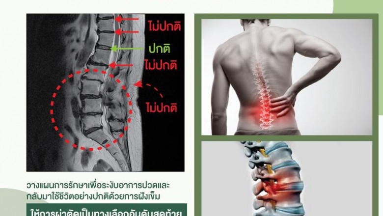 The best way to Discover A fantastic Acupuncture Clinic