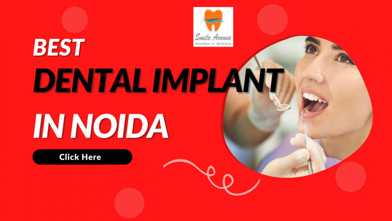 Best Dentist In Sector 19 Noida-Dr. Vasundhara's Smile Dental Avenue