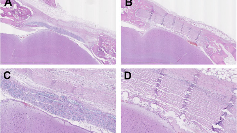 Biological Dural Repair Market 2021 Industry Outlook, Comprehensive Insights, Growth and Forecast 2028