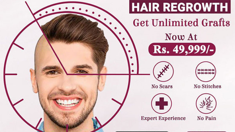 Hair Transplantation Treatment in Hyderabad