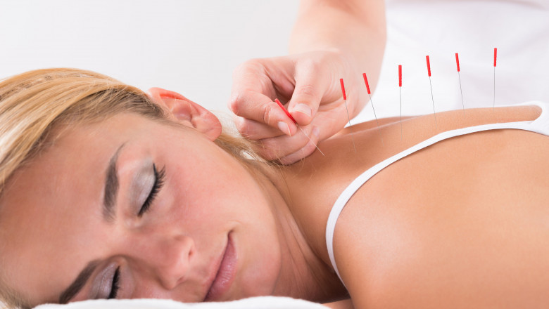 Get rid of Low Back Pain with Acupuncture Therapy